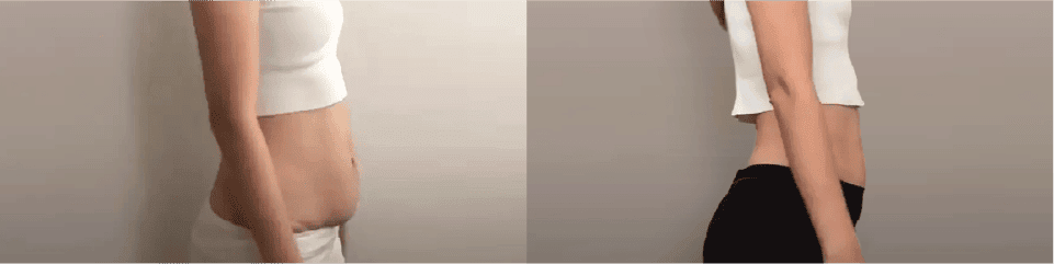 Slimming transformation showing before and after weight loss results at Cheryl W Wellness.